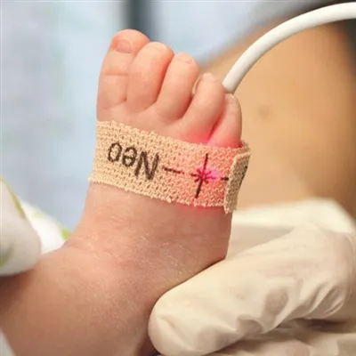 Unstable SpO2 Signals in OR? Disposable Probe Material Upgrade Solves Low Per...